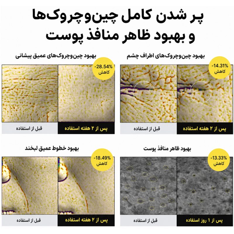 بوستر ضد چروک و جوانساز رتینال شات سلیمکس