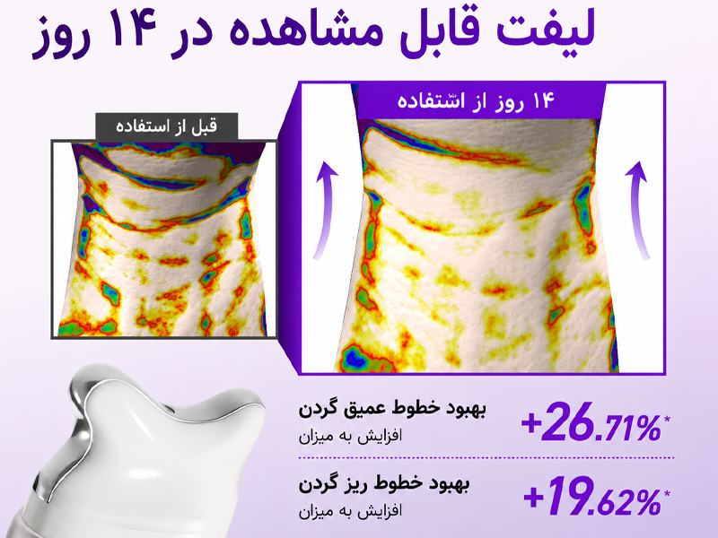 کرم گواشا جوانساز کلاژن و رتینول آنوا 27 نتیجه استفاده