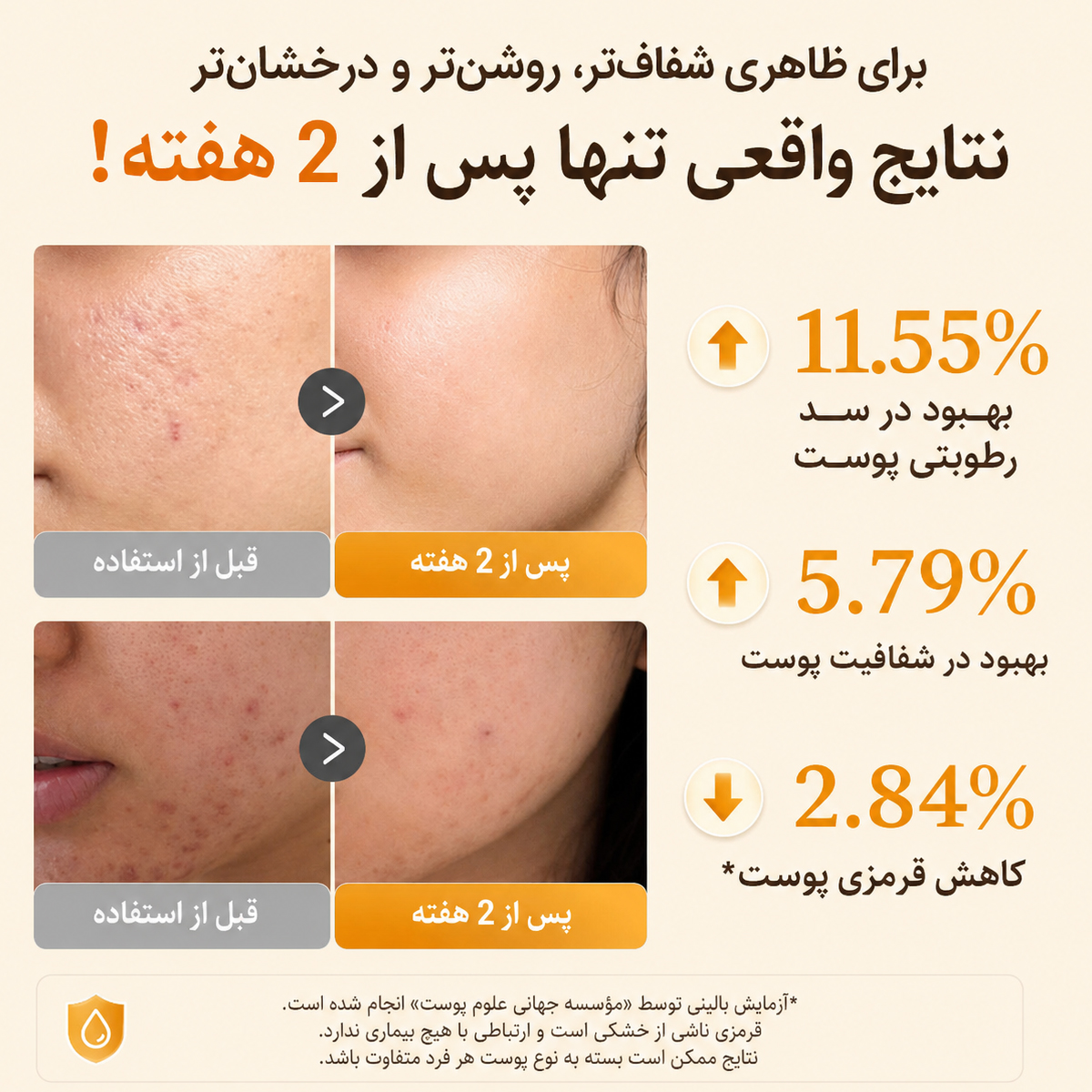 سرم روشن کننده و ضد لک کوجیک اسید مدی کیوب 7 نتایج استفاده از سرم کوجیک اسید مدی کیوب