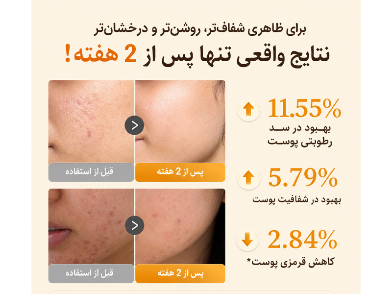 سرم روشن کننده و ضد لک کوجیک اسید مدی کیوب 15 نتایج تست های بالینی سرم کوجیک اسید مدی کیوب
