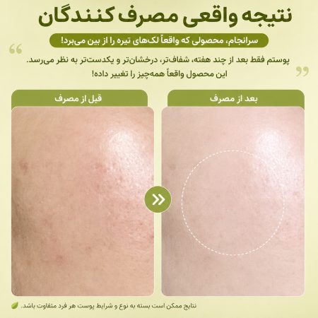 نتایج کلینیکال ژل کرم آرنسیا