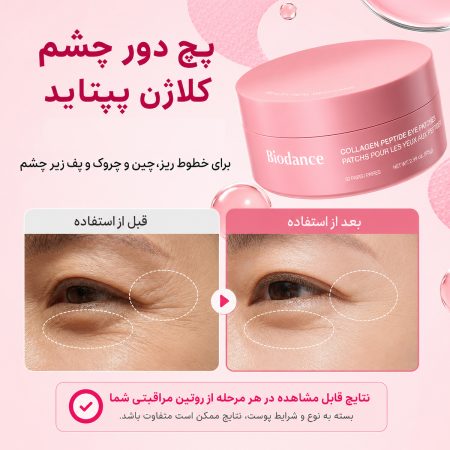 biodance collagen peptide eye patches before after 1
