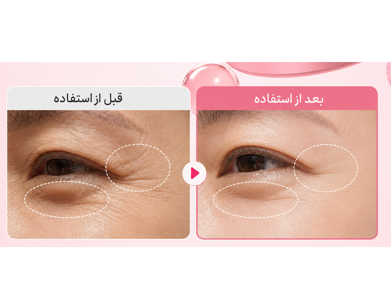 نتایج کلینیکال