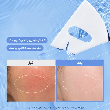ماسک ورقه ای آبرسان سرانول بایودنس 12 biodance hydro cera nol real deep mask before after 1