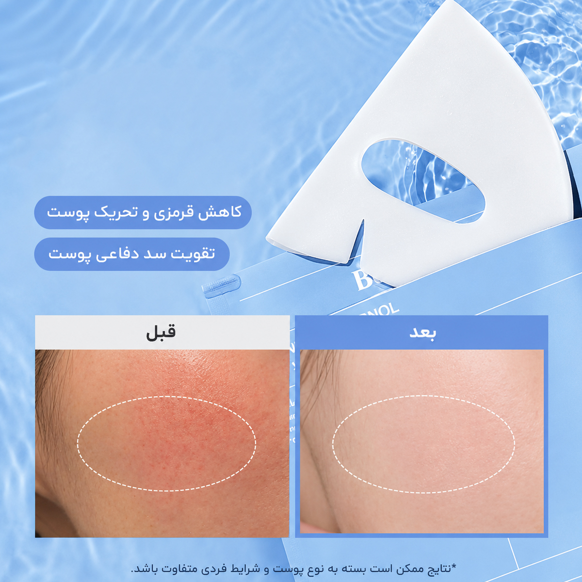 ماسک ورقه ای آبرسان سرانول بایودنس 6 ماسک ورقه ای آبرسان سرانول بایودنس - Image 6