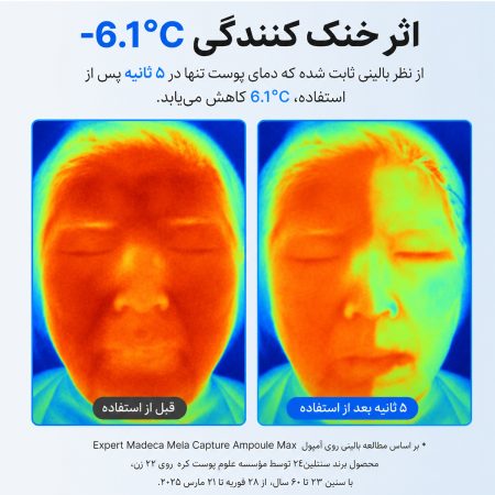 centellian24 madeca cream time reverse zero clinical result