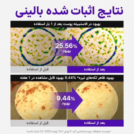 کرم ترمیم کننده PDRN مادکا اکتیو رنیو سنتلیان 24 16 centellian24 pdrn before after