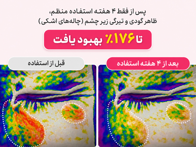 کرم ضد چروک و روشن کننده اسپیکول صورتی دکتر ملاکسین 14 نتایج کلینیکال