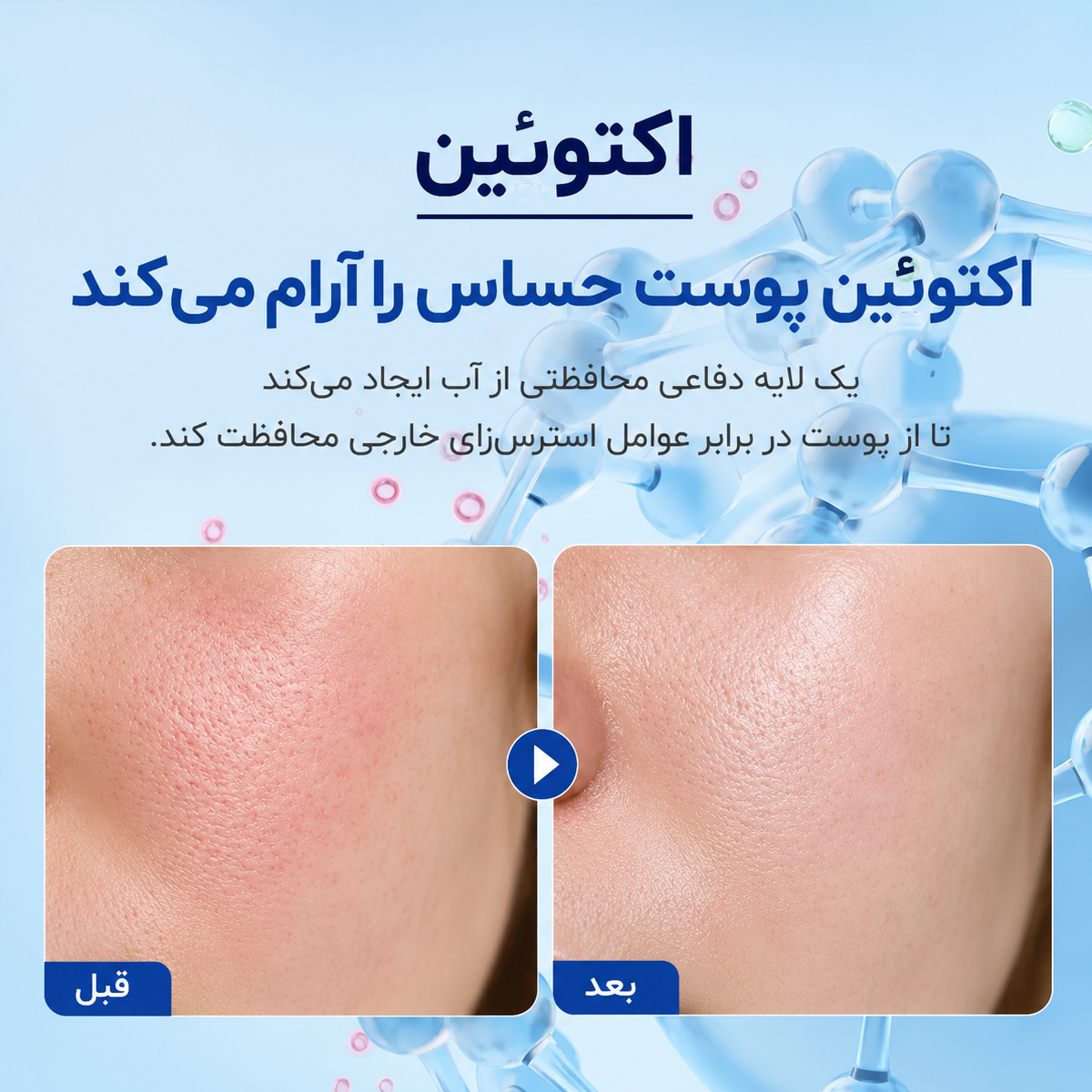 کرم دابل آپ اکتوئین و پنتنول ای پی 8 کرم دابل آپ اکتوئین و پنتنول ای پی - Image 8