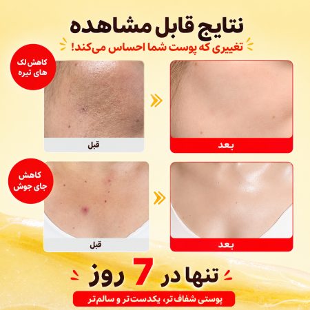 eqqualberry vitamin illuminating cream before after