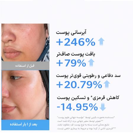 ژل کرم آبرسان هیالورونیک اسید و سرامید مدی کیوب 13 medicube hyaluronic ceramide jelly cream before after
