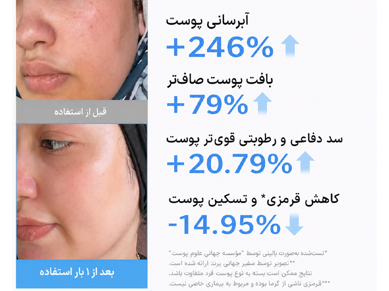 ژل کرم آبرسان هیالورونیک اسید و سرامید مدی کیوب 16 نتایج کلینیکال