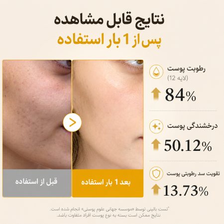 میست سرم روشن کننده کوجیک اسید مدی کیوب 13 نتیجه استفاده از میست سرم روشن کننده کوجیک اسید مدی کیوب