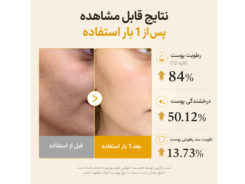 میست سرم روشن کننده کوجیک اسید مدی کیوب 16 نتیجه استفاده از میست سرم روشنکننده کوجیک اسید مدی کیوب