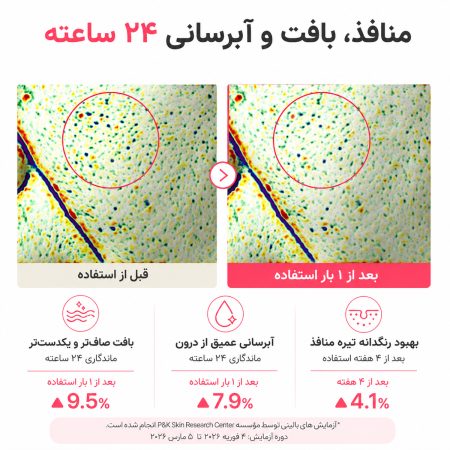 نتایج بالینی مرطوب‌ کننده میلکی بیفیدا و باکوچیول زیرو پور شماره ۳ نامبوزین