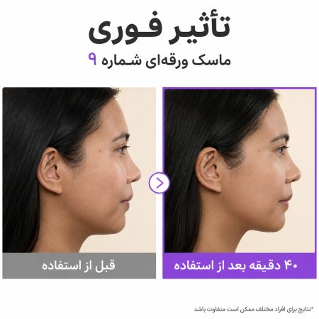 numbuzin no9 nad bio lifting sil special set before after