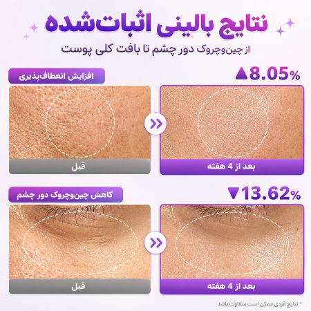 numbuzin no9 nad bio lifting sil special set clinical result