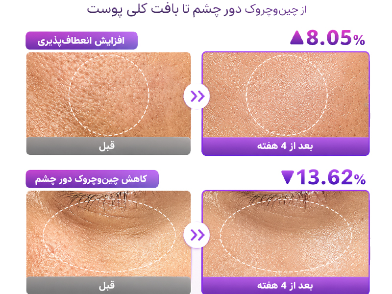 نتایج کلینیکال