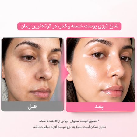 قبل و بعد استفاده از ماسک صورت پیل‌ آف کلاژن و PDRN درخشان‌ کننده پیوریتو سئول
