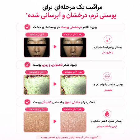 نتیجه بالینی کرم ترمیم‌ کننده PDRN ۱.۵٪ سنتلا ماداگاسکار اسکین ۱۰۰۴