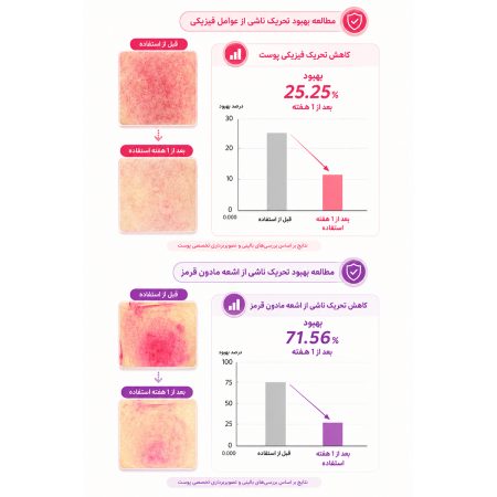 نتیجه استفاده از کرم ترمیم‌ کننده PDRN ۱.۵٪ سنتلا ماداگاسکار اسکین ۱۰۰۴