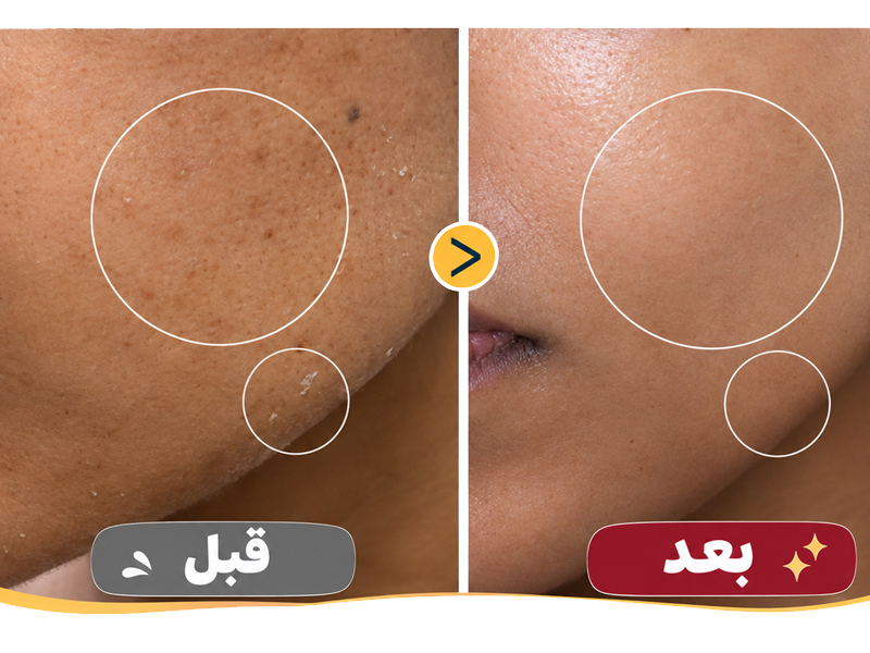 نتیجه استفاده از تونر پیل‌ شات روشن‌ کننده برنج دکتر ملاکسین