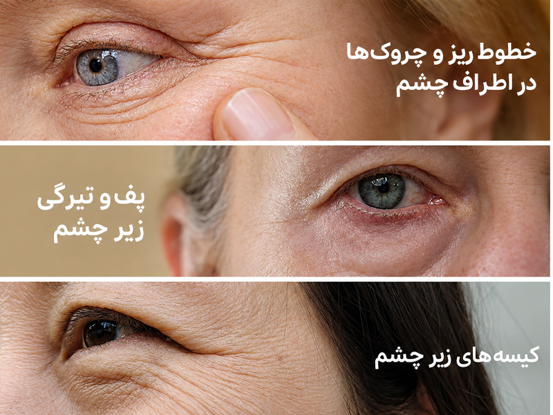 کرم دور چشم ضد چروک و سفت‌ کننده کلسیم دکتر ملاکسین مناسب چه کسانی است؟