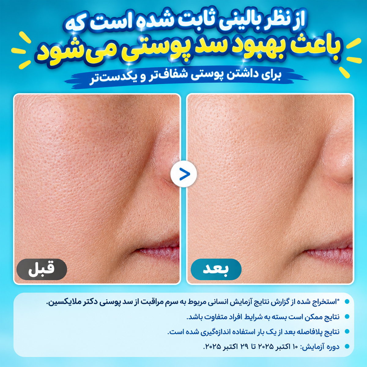 سرم پیل شات ترانگزامیک اسید روشن کننده و لایه بردار ملایم دکتر ملاکسین 4 سرم پیل شات ترانگزامیک اسید روشن کننده و لایه بردار ملایم دکتر ملاکسین - Image 4