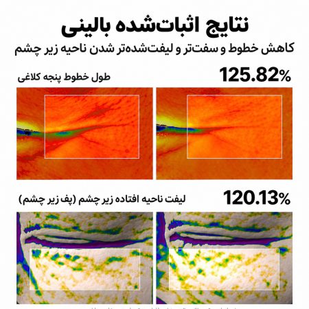 dr melaxin firmer eye area result