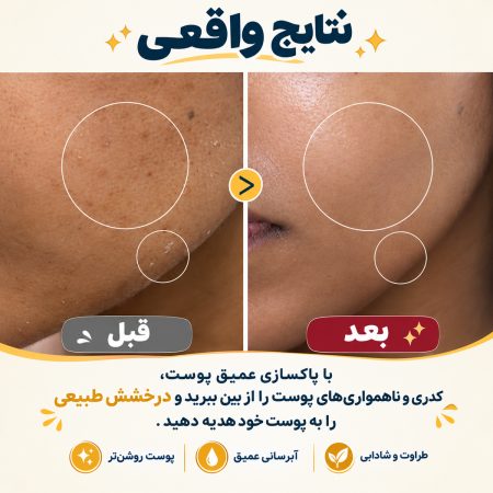 dr melaxin glowing skin result