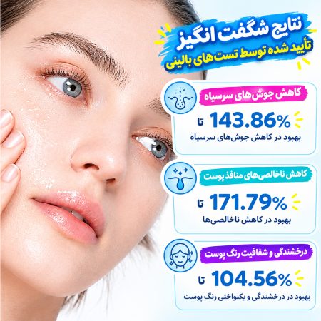 سرم پیل شات ترانگزامیک اسید روشن کننده و لایه بردار ملایم دکتر ملاکسین 7 نتیجه استفاده از سرم پیل شات ترانگزامیک اسید روشن کننده و دکتر ملاکسین