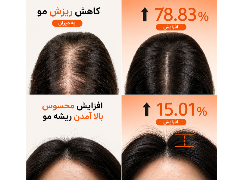 شامپو حجم دهنده و تقویت کننده مو لیلیو 14 نتایج کلینیکال