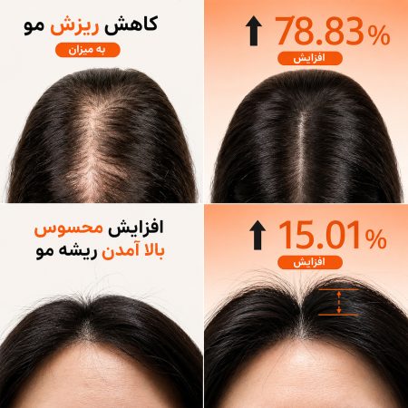 شامپو حجم دهنده و تقویت کننده مو لیلیو 10 lilyeve volumized hair result